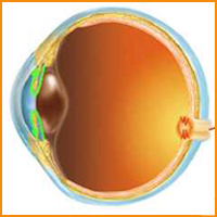 szembetegség glaukóma myopia)